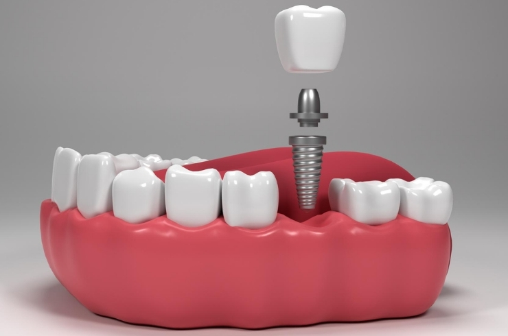 VR Dental Clinic
